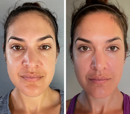 EMS Face Lifter – Tone, Tighten & Glow